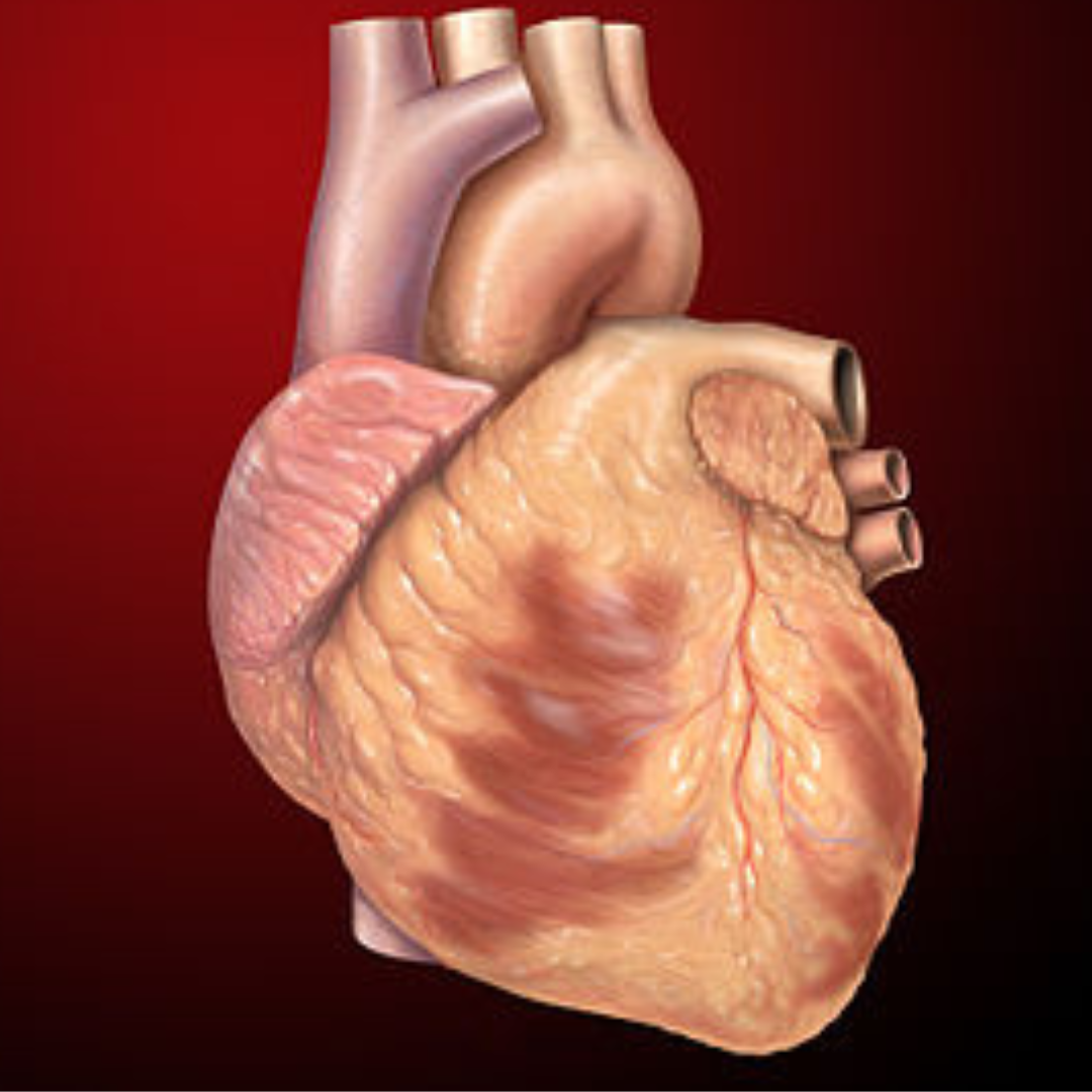 Amiloidose cardíaca