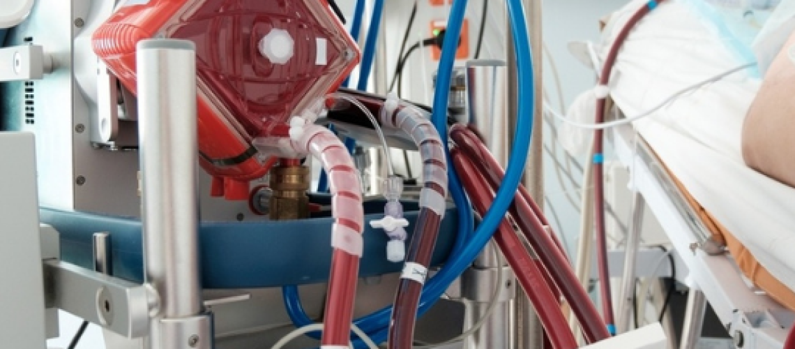 ECMO